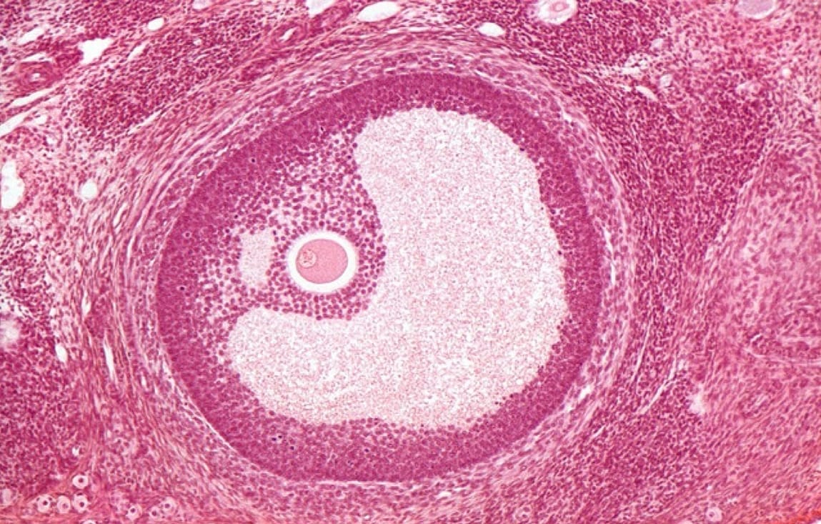 What is an ovarian follicle? 2