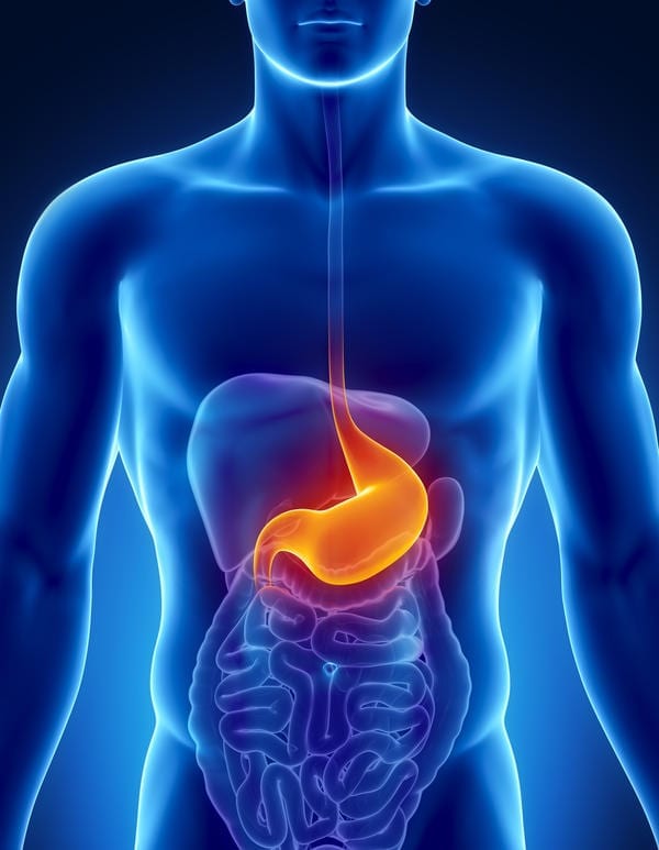 Stomach ulcers: disease triggered by high acid production 1