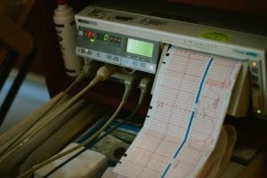 ECG Machine