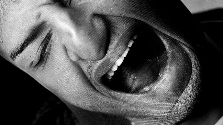 Wisdom Teeth pain