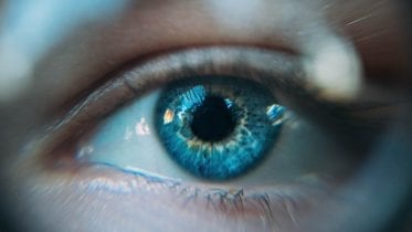 laser eye surgery